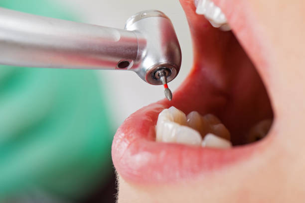 Best Urgent Care for Lost Fillings or Crowns in Newport, OH